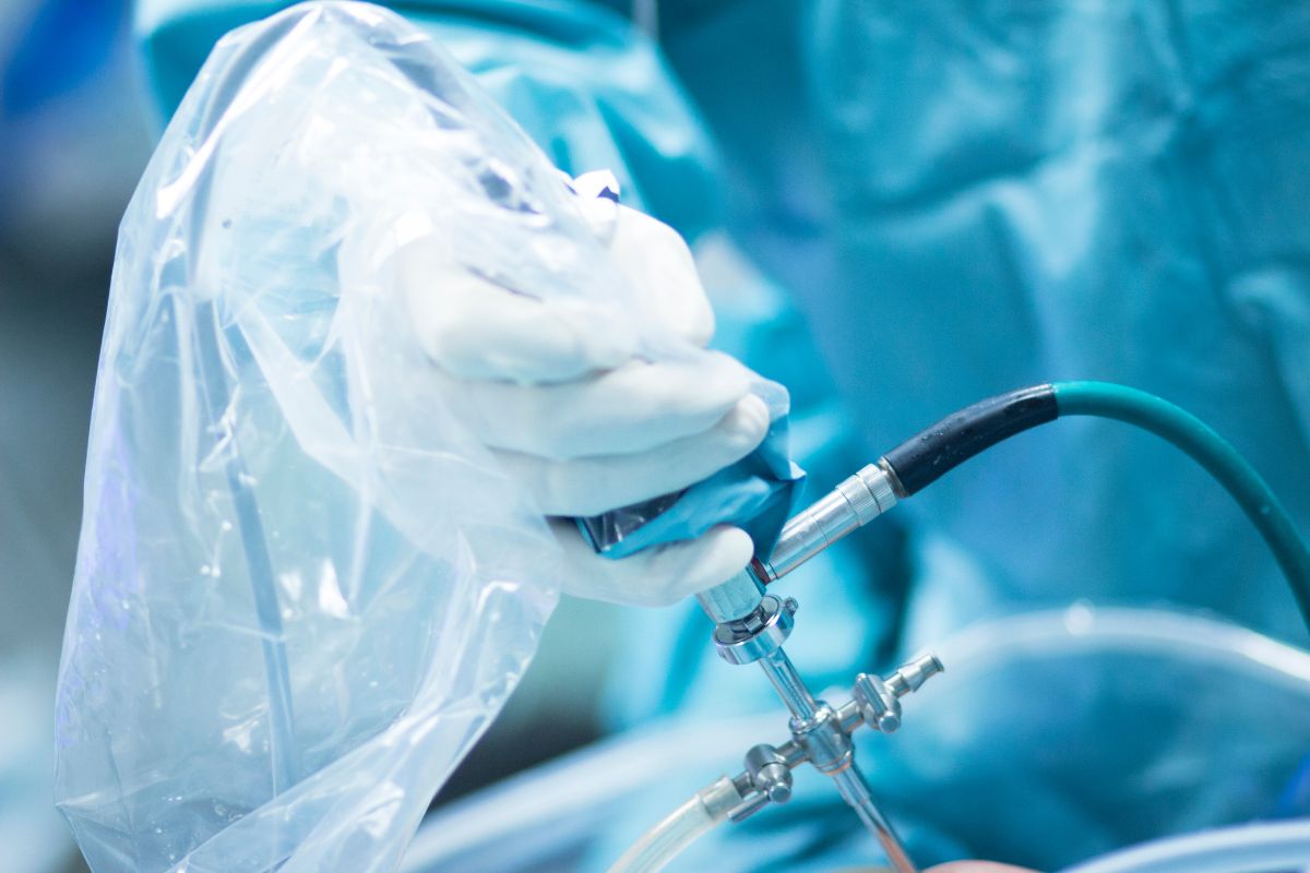 Arthroscopic Surgery