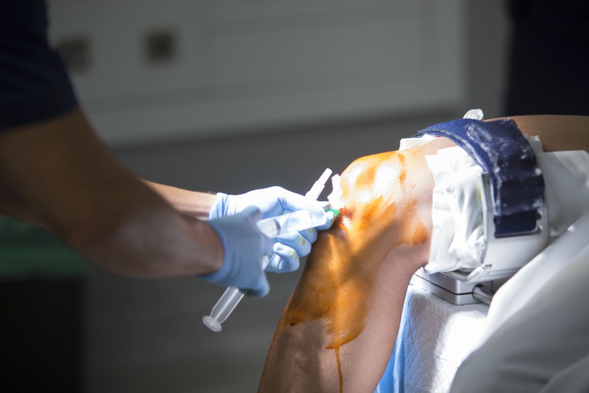 Joint Replacement Surgery